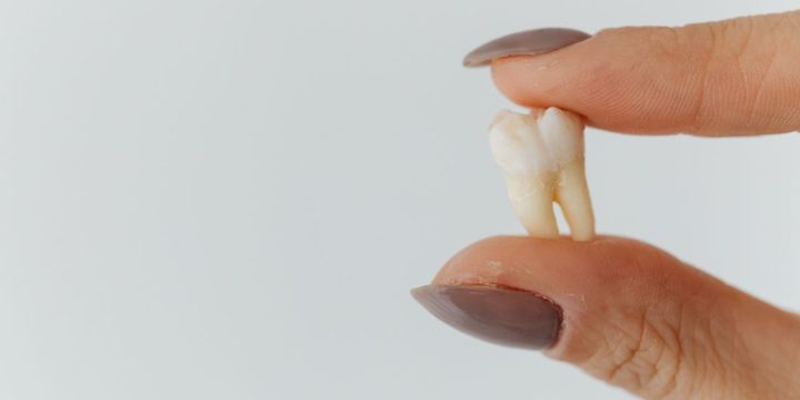 The 30-Minute Window: What to Do the Moment a Tooth Gets Knocked Out
